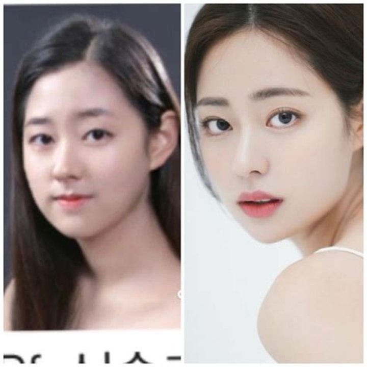 An Min Young Singles Inferno Plastic Surgery: Before And After Photos