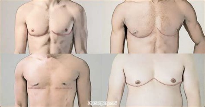 Ander Puig Before Surgery: Did He Have Top Or Bottom Surgery?