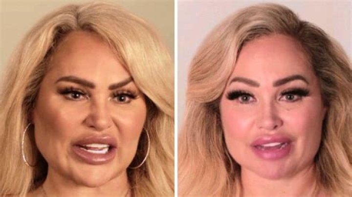 Before Plastic Surgery and After — Darcey Silva and Her Transformation Explored