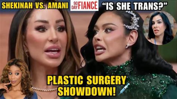 Shane 90 Day Fiance Surgery: Before And After Photos