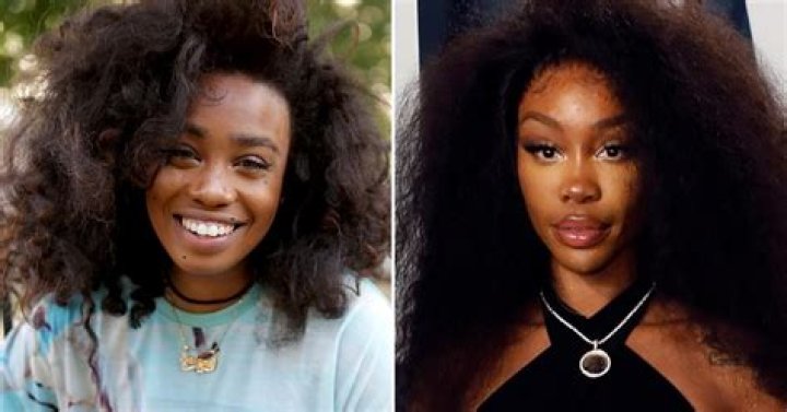 Has SZA Had Plastic Surgery? Fans Think So and Here Are the Alleged before and after Pictures